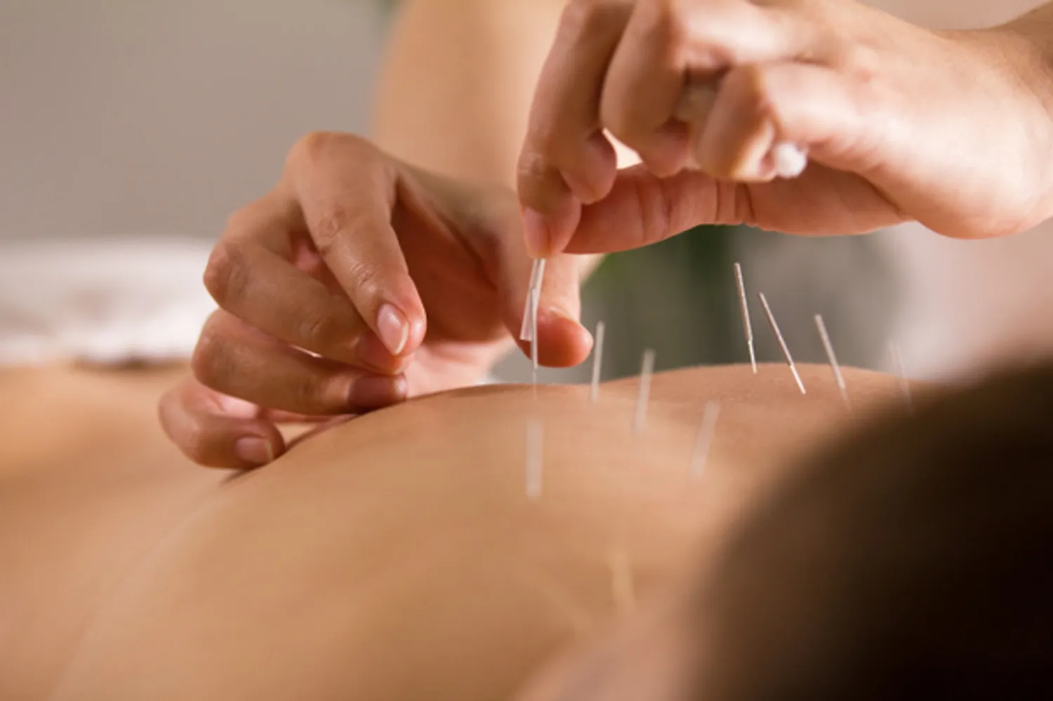 image de pratique de medecine chinoise